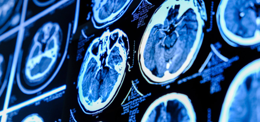 Welcome to Studiowide, North West Neurosurgery Network